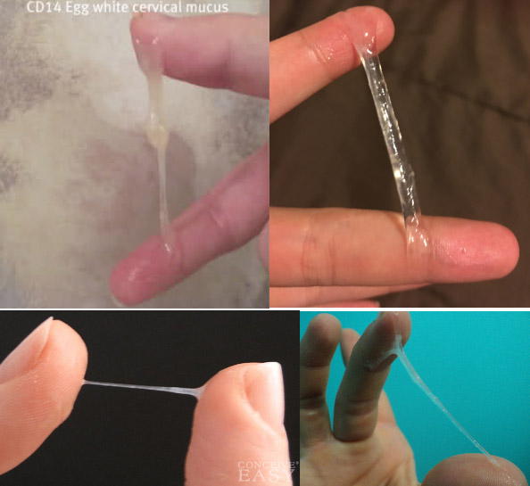 Muco eggwhite (clara de ovo) — elástico e transparente, sinal de fertilidade máxima