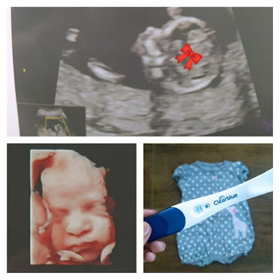Minha segunda gravidez - um bebê muito desejado