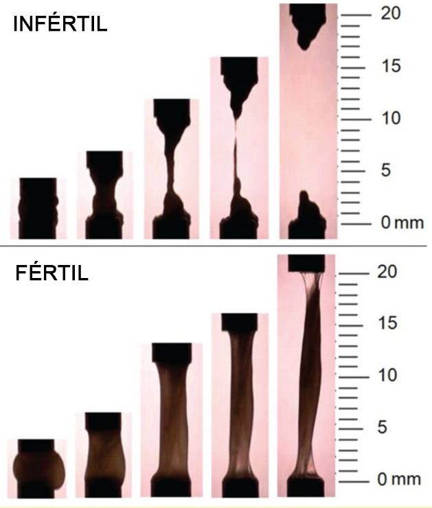 Comparação visual entre muco cervical fértil e infértil, mostrando fluidez e elasticidade