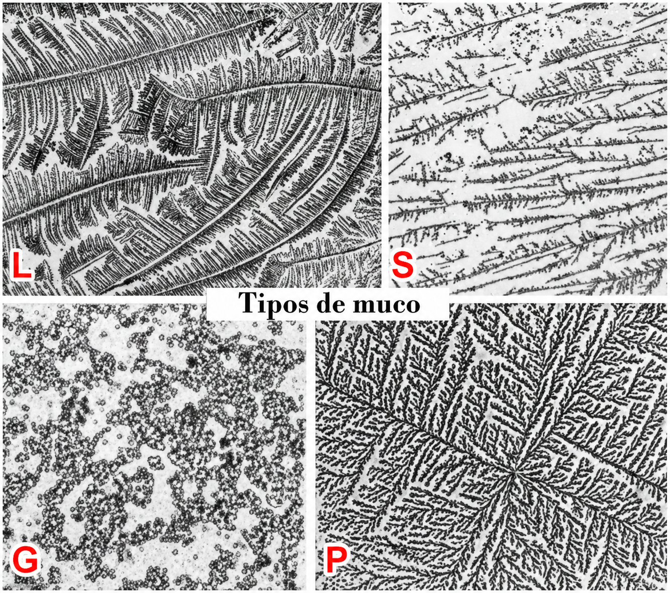 Padrão de arborização (samambaia) do muco cervical fértil visto ao microscópio — ferning test