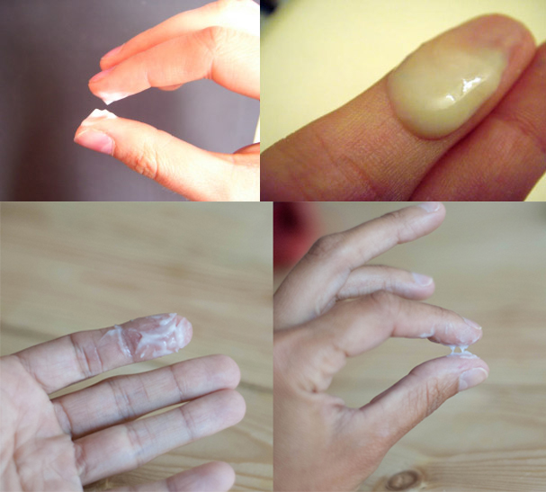 Muco creamy (cremoso) — parecido com creme hidratante, comum na fase lútea